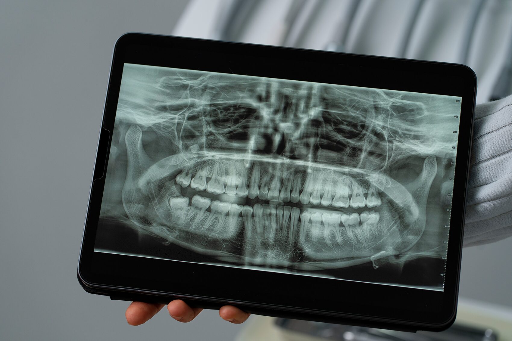 Harald Tandlægerne, Fra drøm til virkelighed – Mød vores yngste tandlæge Anders Skyum - Scanning Roenten 1